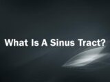 What Is A Sinus Tract?